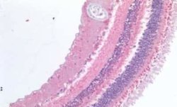 ABCA4 Antibody, Novus Biologicals 50 &mu;g; Unconjugated:Antibodies, Polyclonal
